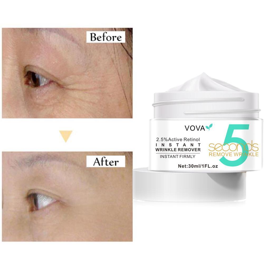 2.5% Retinolo Attivo Crema Per - Milk Thistle Silymarin recensione e prezzo
